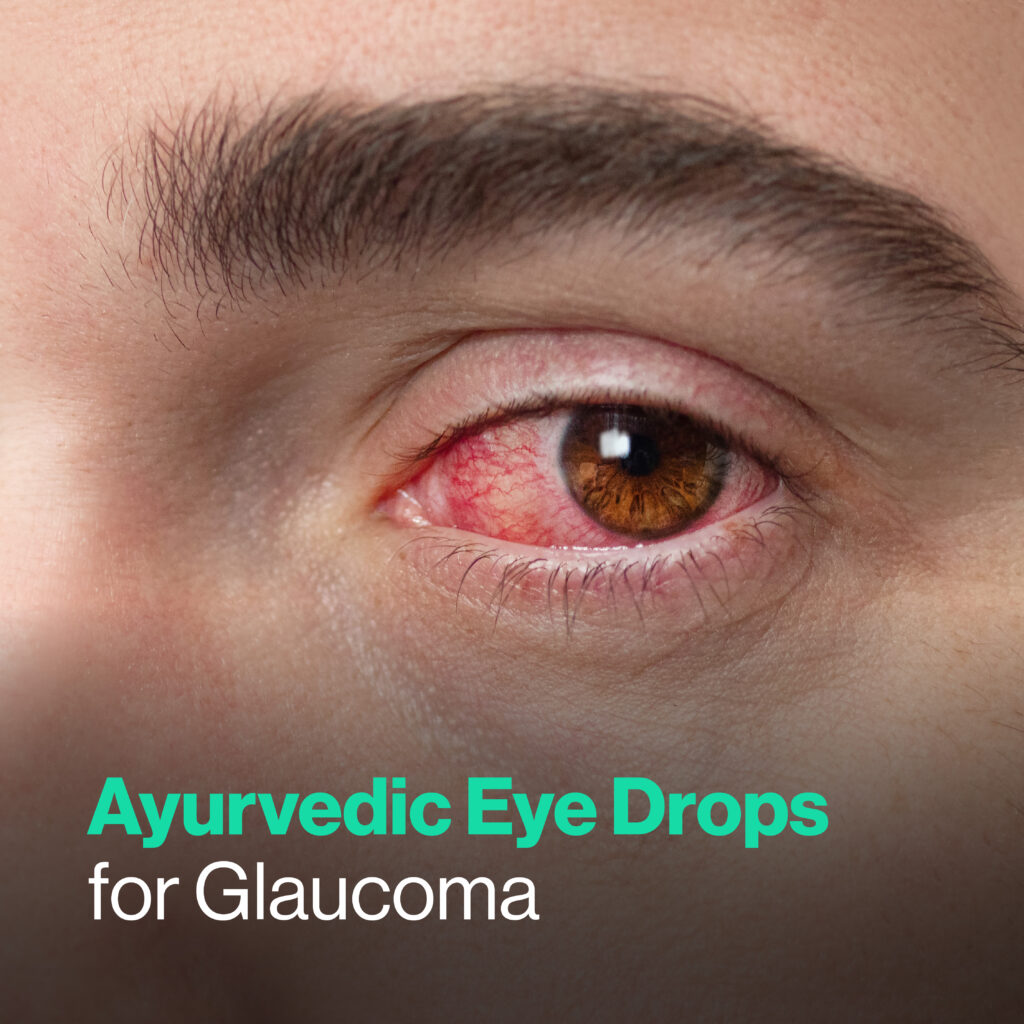 Ayurvedic Eye Drops for Glaucoma
