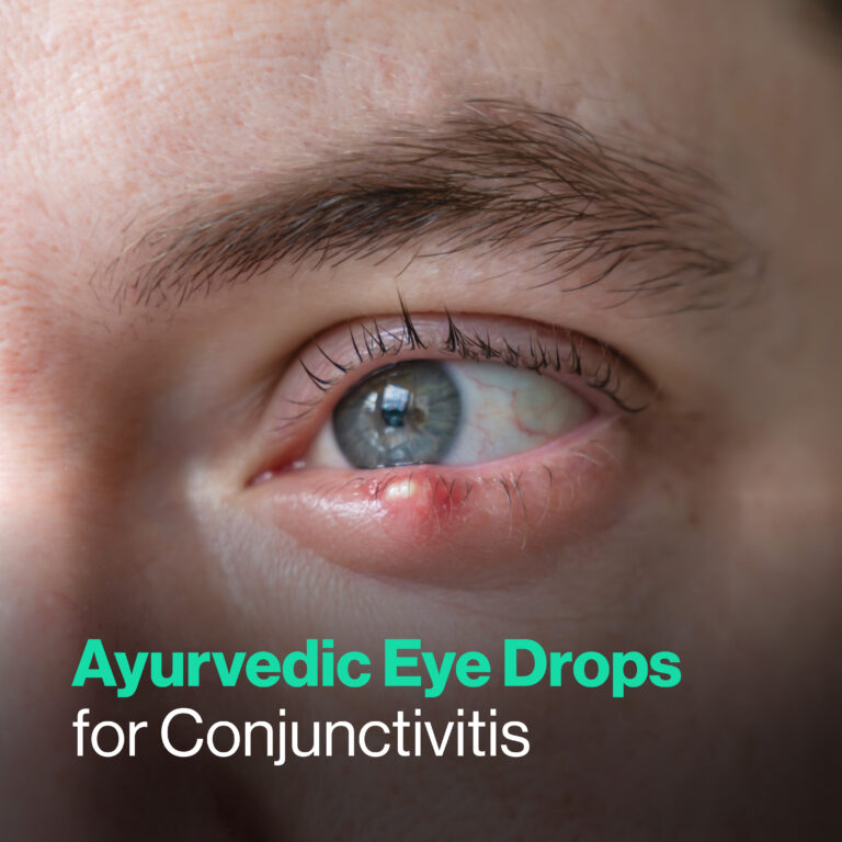 Ayurvedic Eye Drops for Conjunctivitis