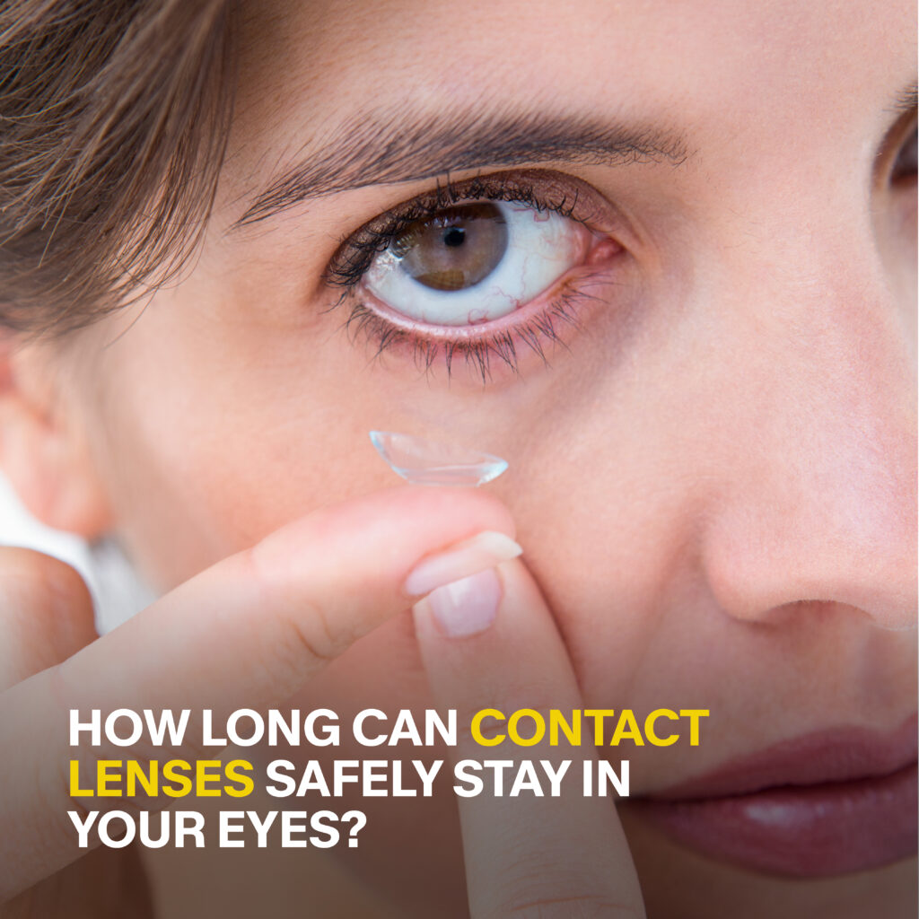 How Long Can Contact Lenses Safely Stay in Your Eyes?