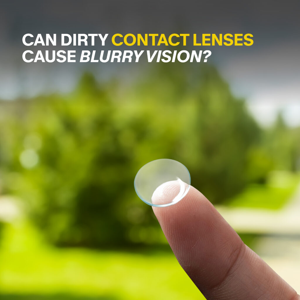 Can Dirty Contact Lenses Cause Blurry Vision?